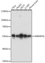 hnRNP H1 Antibody in Western Blot (WB)