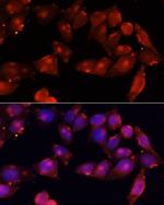 ACVR2B Antibody in Immunocytochemistry (ICC/IF)