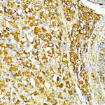 VAMP1 Antibody in Immunohistochemistry (Paraffin) (IHC (P))