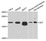 Somatostatin Antibody in Western Blot (WB)