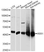 ASS1 Antibody in Western Blot (WB)