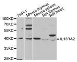 IL13RA2 Antibody in Western Blot (WB)