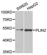 ADFP Antibody in Western Blot (WB)