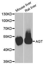 Angiotensinogen Antibody in Western Blot (WB)