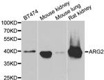 Arginase 2 Antibody in Western Blot (WB)