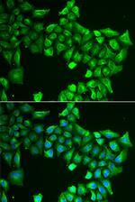 ASL Antibody in Immunocytochemistry (ICC/IF)