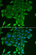 CD84 Antibody in Immunocytochemistry (ICC/IF)