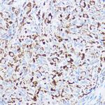 Monoacylglycerol Lipase Antibody in Immunohistochemistry (Paraffin) (IHC (P))