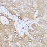 Monoacylglycerol Lipase Antibody in Immunohistochemistry (Paraffin) (IHC (P))