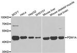 PPM1A Antibody in Western Blot (WB)