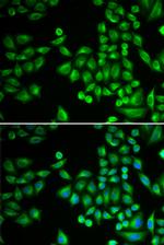 PTP1B Antibody in Immunocytochemistry (ICC/IF)