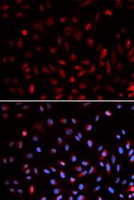 ERCC1 Antibody in Immunocytochemistry (ICC/IF)