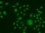 ERCC1 Antibody in Immunocytochemistry (ICC/IF)