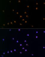 SNAIL Antibody in Immunocytochemistry (ICC/IF)