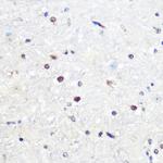 SNAIL Antibody in Immunohistochemistry (Paraffin) (IHC (P))