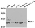 CDK5 Antibody in Western Blot (WB)