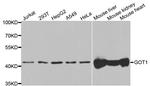 GOT1 Antibody in Western Blot (WB)