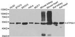 ATP5A1 Antibody in Western Blot (WB)