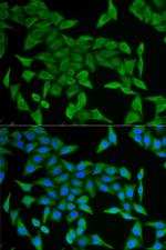 CRABP2 Antibody in Immunocytochemistry (ICC/IF)