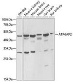 ATP6IP2 Antibody in Western Blot (WB)