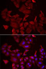 Caspase 14 Antibody in Immunocytochemistry (ICC/IF)