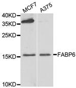 FABP6 Antibody in Western Blot (WB)