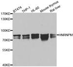 hnRNP M Antibody in Western Blot (WB)