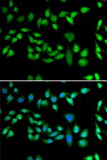 DNAJB6 Antibody in Immunocytochemistry (ICC/IF)