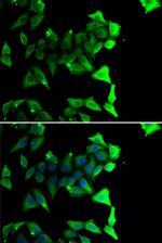 NDE1 Antibody in Immunocytochemistry (ICC/IF)