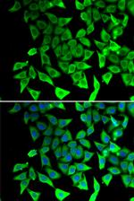 PTGES2 Antibody in Immunocytochemistry (ICC/IF)