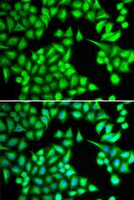 IL-21 Antibody in Western Blot (WB)