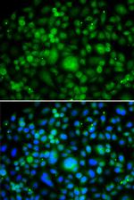 SMYD3 Antibody in Immunocytochemistry (ICC/IF)