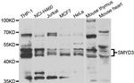 SMYD3 Antibody in Western Blot (WB)