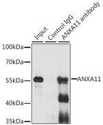 Annexin A11 Antibody in Immunoprecipitation (IP)