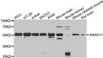 Annexin A11 Antibody in Western Blot (WB)