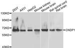 CNDP1 Antibody in Western Blot (WB)