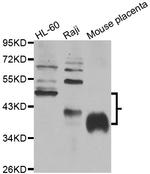 FCGR2B Antibody in Western Blot (WB)