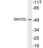 SMYD2 Antibody in Western Blot (WB)