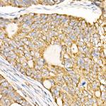 Prohibitin Antibody in Immunohistochemistry (Paraffin) (IHC (P))