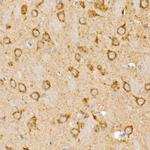 Prohibitin Antibody in Immunohistochemistry (Paraffin) (IHC (P))