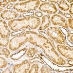 Prohibitin Antibody in Immunohistochemistry (Paraffin) (IHC (P))