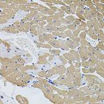 Calpastatin Antibody in Immunohistochemistry (Paraffin) (IHC (P))