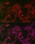 LRP5 Antibody in Immunocytochemistry (ICC/IF)