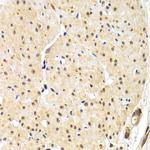 TRF1 Antibody in Immunohistochemistry (Paraffin) (IHC (P))