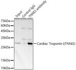 Cardiac Troponin I Antibody in Immunoprecipitation (IP)