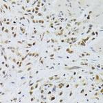 RAD50 Antibody in Immunohistochemistry (Paraffin) (IHC (P))