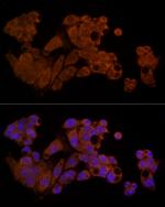 Caspase 8 Antibody in Immunocytochemistry (ICC/IF)