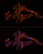 Caspase 8 Antibody in Immunocytochemistry (ICC/IF)