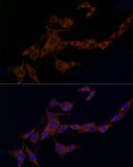 Caspase 8 Antibody in Immunocytochemistry (ICC/IF)