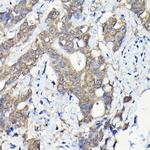 Caspase 8 Antibody in Immunohistochemistry (Paraffin) (IHC (P))